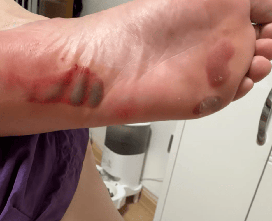 “月瘦20斤”“很多人都在用”<strong></p>
<p>宏鑫機(jī)械設(shè)備有限公司
</strong>！女子在家跟練突然腳底噴血……:宏鑫機(jī)械設(shè)備有限公司
