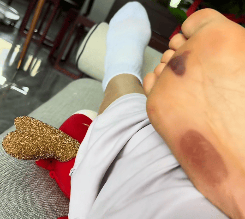 “月瘦20斤”“很多人都在用”<strong></p>
<p>宏鑫機(jī)械設(shè)備有限公司
</strong>！女子在家跟練突然腳底噴血……:宏鑫機(jī)械設(shè)備有限公司
