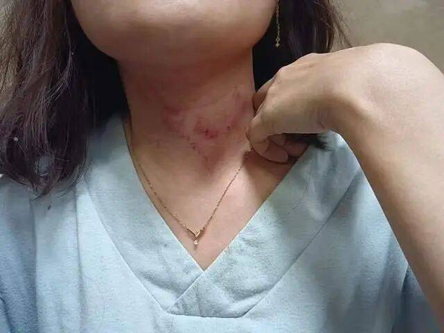 一男子凌晨聽(tīng)到兩聲呼救<strong></p>
<p>宏鑫機(jī)械設(shè)備有限公司
</strong>，循聲發(fā)現(xiàn)一女子在奔馳車外被白衣男勒昏！受害者：是受朋友之托借錢(qián)給白衣男，凌晨被騙至偏僻處遭非禮！:宏鑫機(jī)械設(shè)備有限公司
