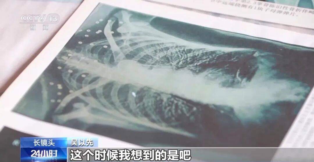 “老先生<strong></p>
<p>宏鑫機械設備有限公司
</strong>，您把項鏈取下來再做CT”“你看是不是彈片”:宏鑫機械設備有限公司
