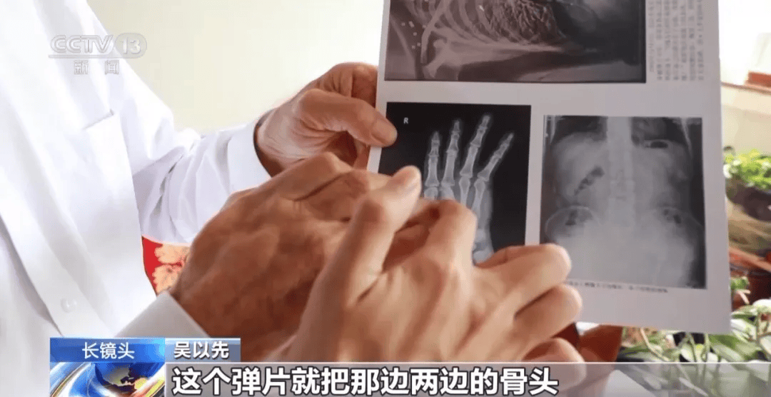 “老先生<strong></p>
<p>宏鑫機(jī)械設(shè)備有限公司
</strong>，您把項(xiàng)鏈取下來再做CT”:宏鑫機(jī)械設(shè)備有限公司
